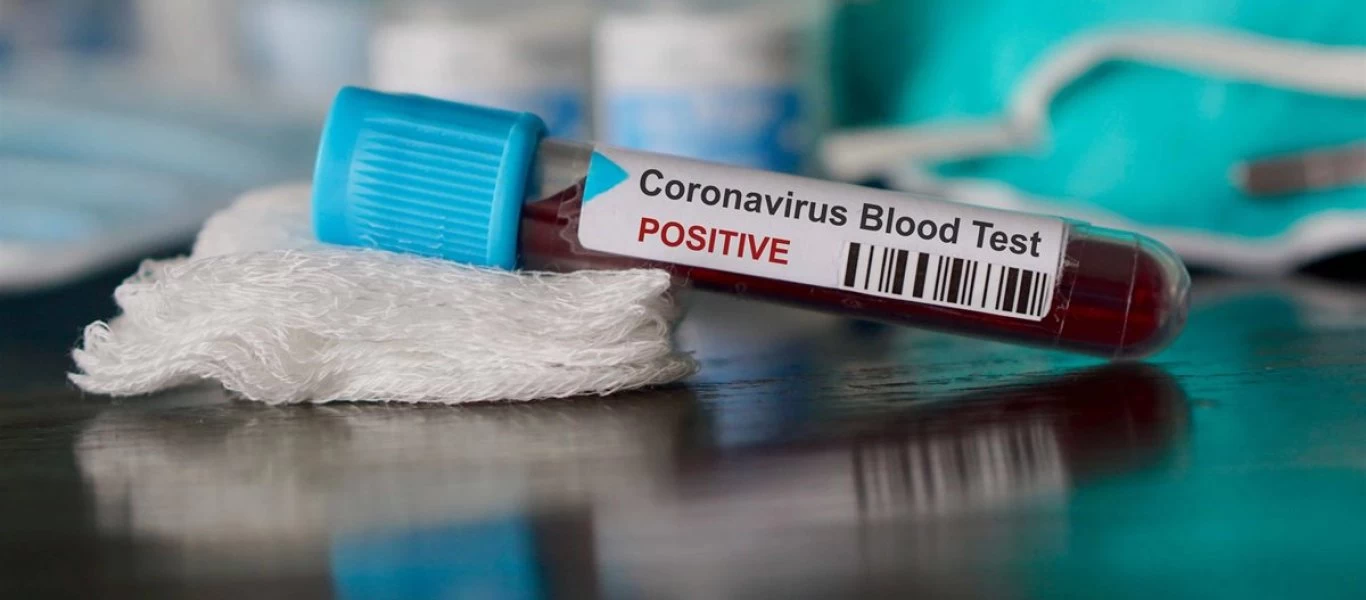 Κορωνοϊός: Η Βρετανία ετοιμάζει τεστ «εξπρές» - Θα χρειάζεται μόνο 10 λεπτά